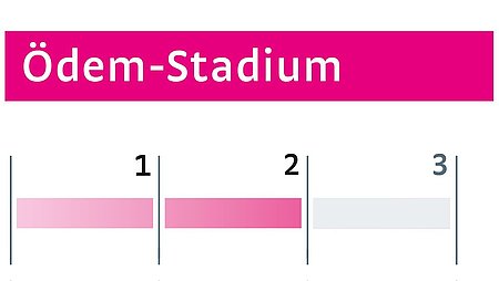 Ödeme Stadium II Ödeme Stadium II - Ödeme Stadium II