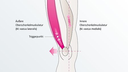 Oberschenkel Anatomie Oberschenkel Anatomie