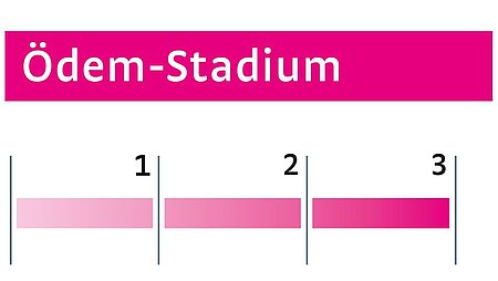 Ödeme Stadium III Ödeme Stadium III - Ödeme Stadium III