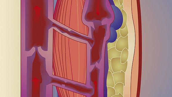 Varicose veins illustration -