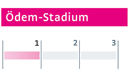 Ödeme Stadium I Ödeme Stadium I - Ödeme Stadium I