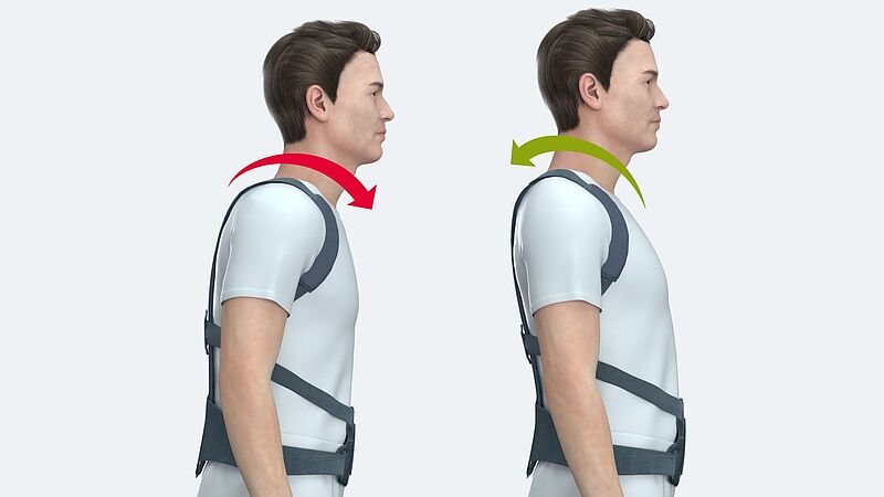 Spinomed Rückenorthese: Biofeedback-Prinzip bei Osteoporose Spinomed Rückenorthese: Biofeedback-Prinzip bei Osteoporose