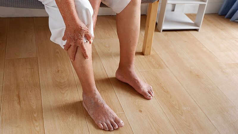 Frau hält sich das Bein aufgrund eines Venenleidens
